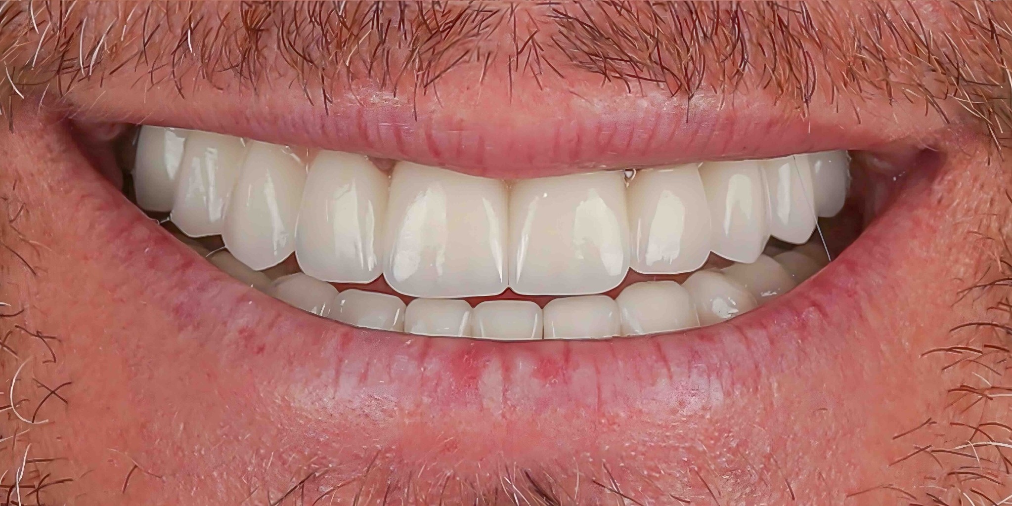 Before and after comparison