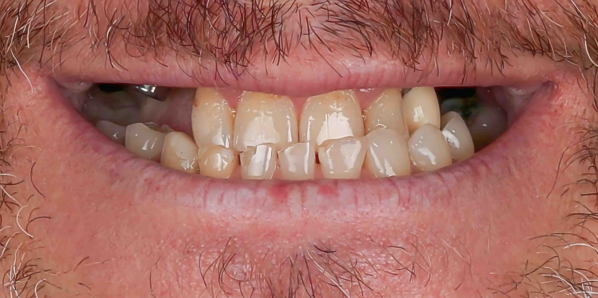 Before and after comparison