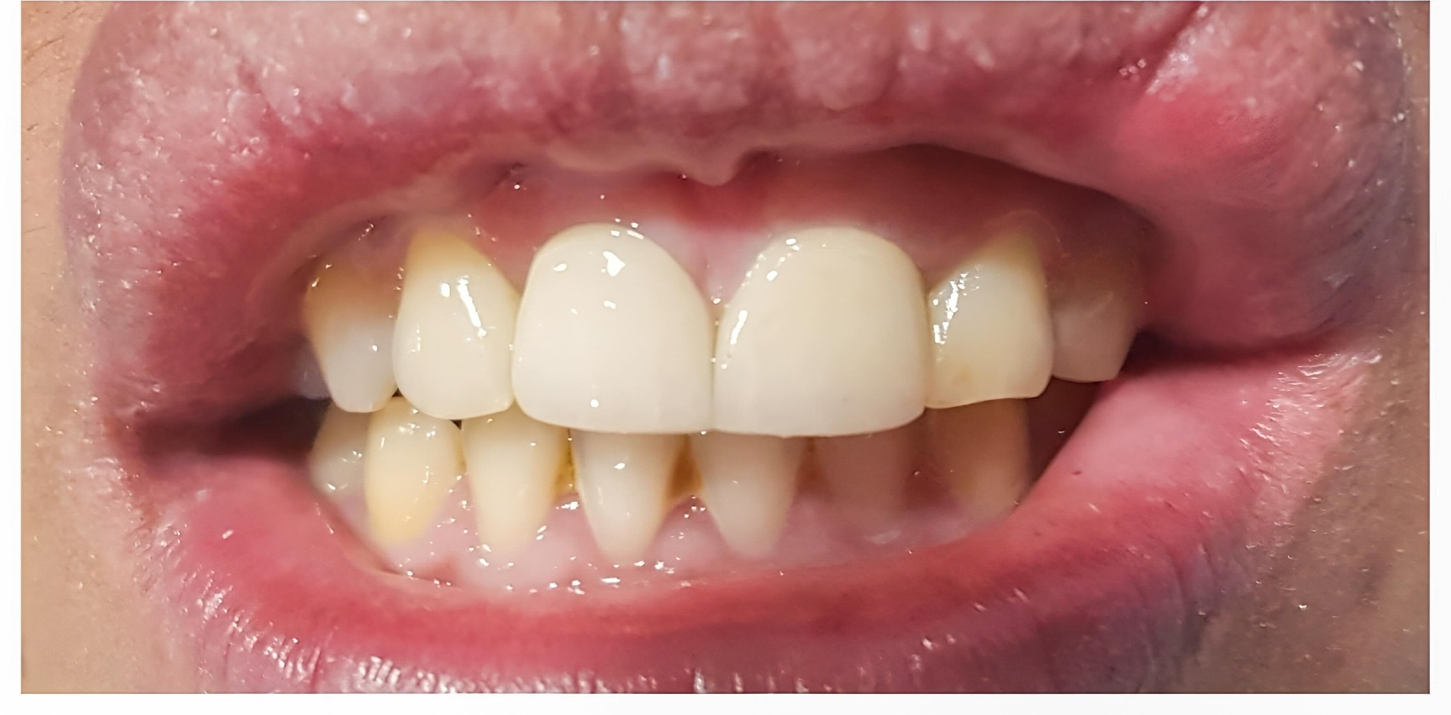 Before and after comparison