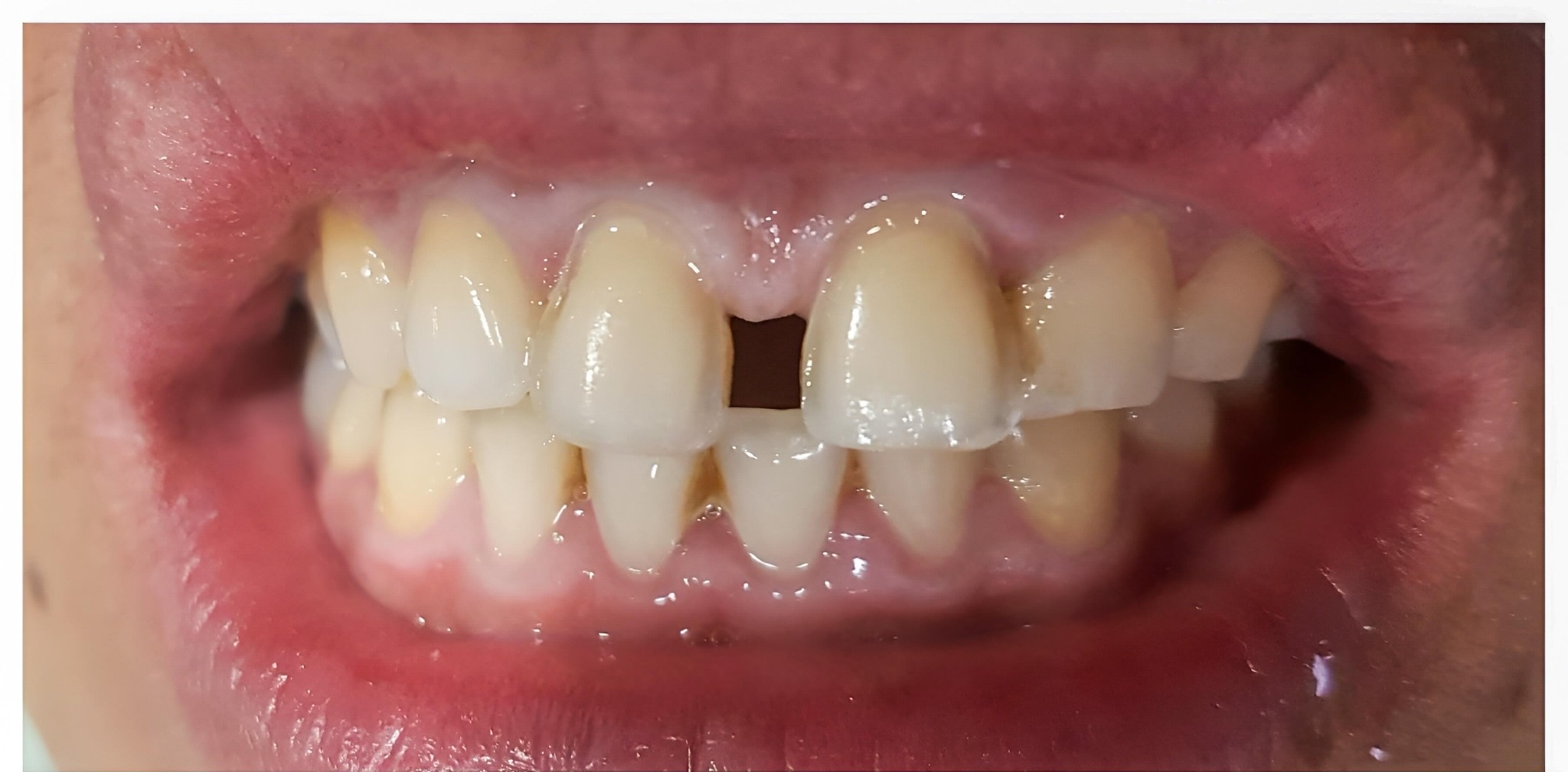 Before and after comparison