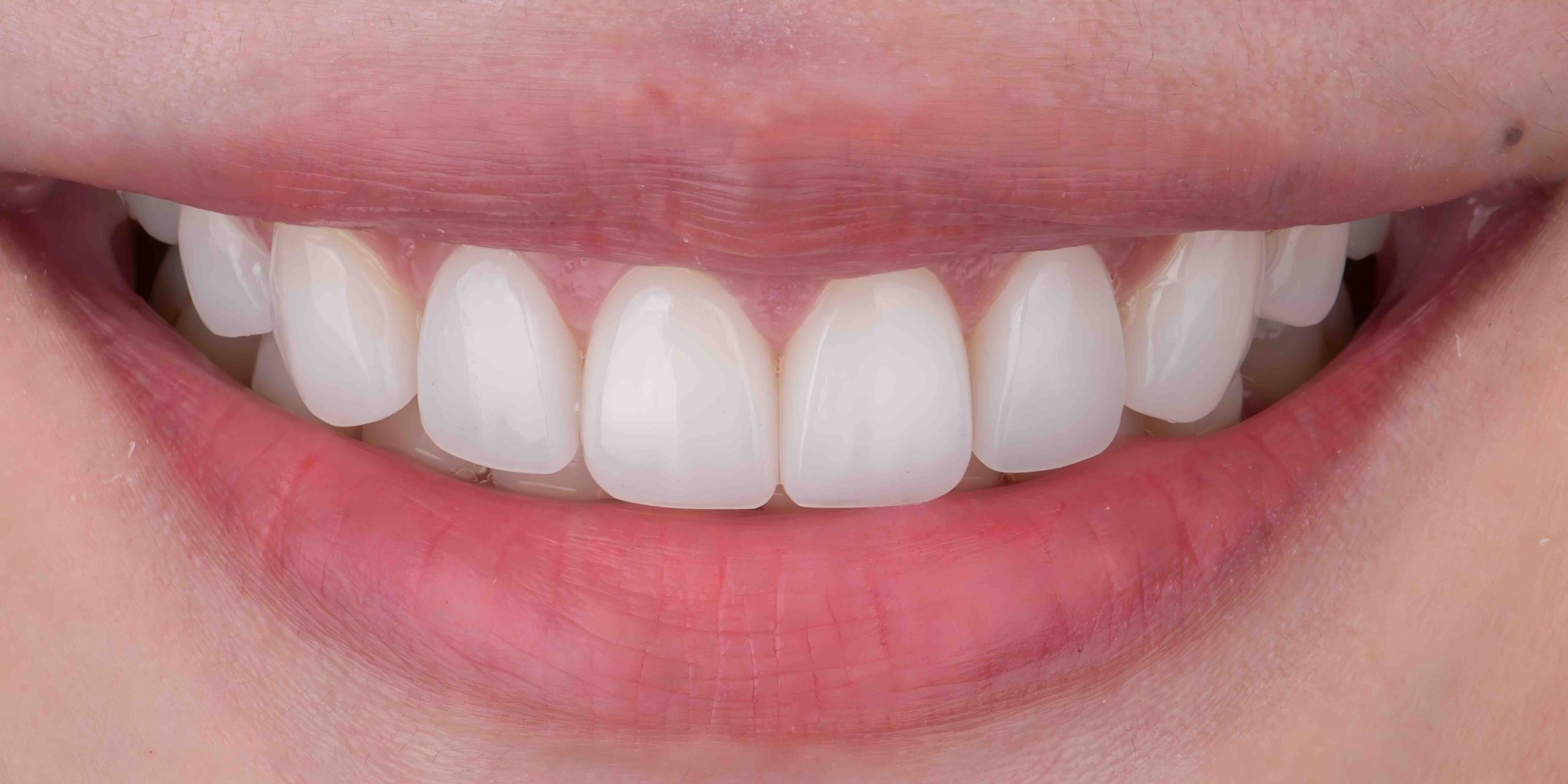 Before and after comparison