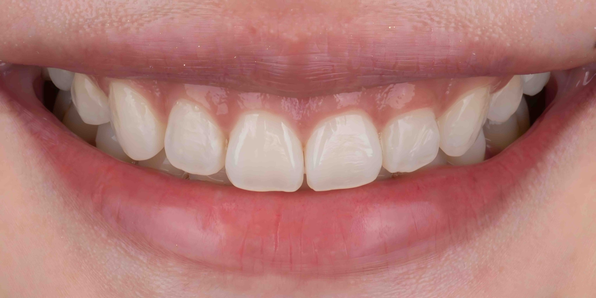 Before and after comparison