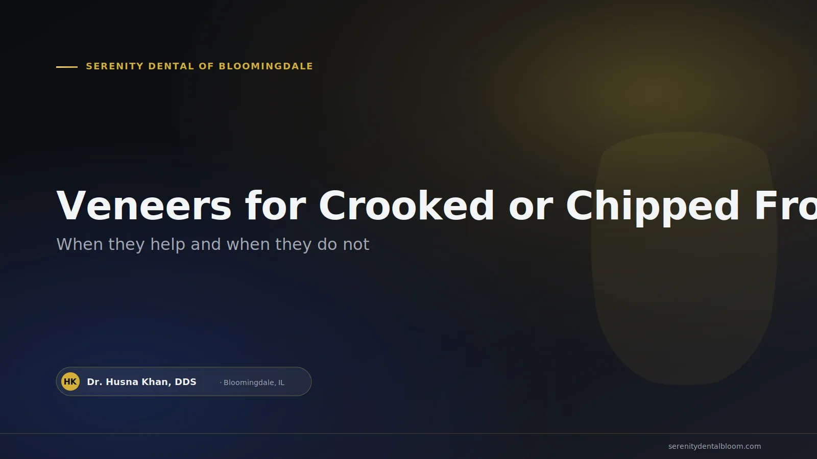 Veneers for Crooked or Chipped Front Teeth: When They Help and When They Do Not