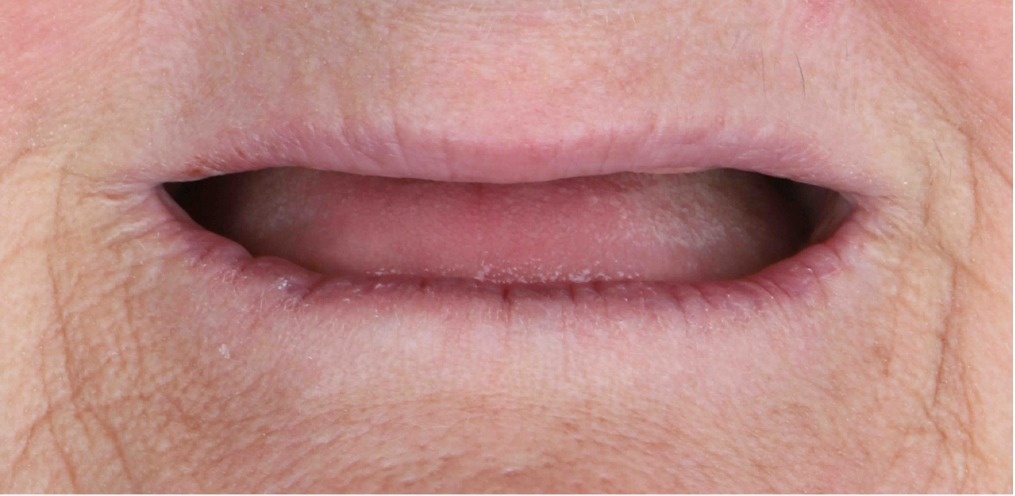 Before and after comparison