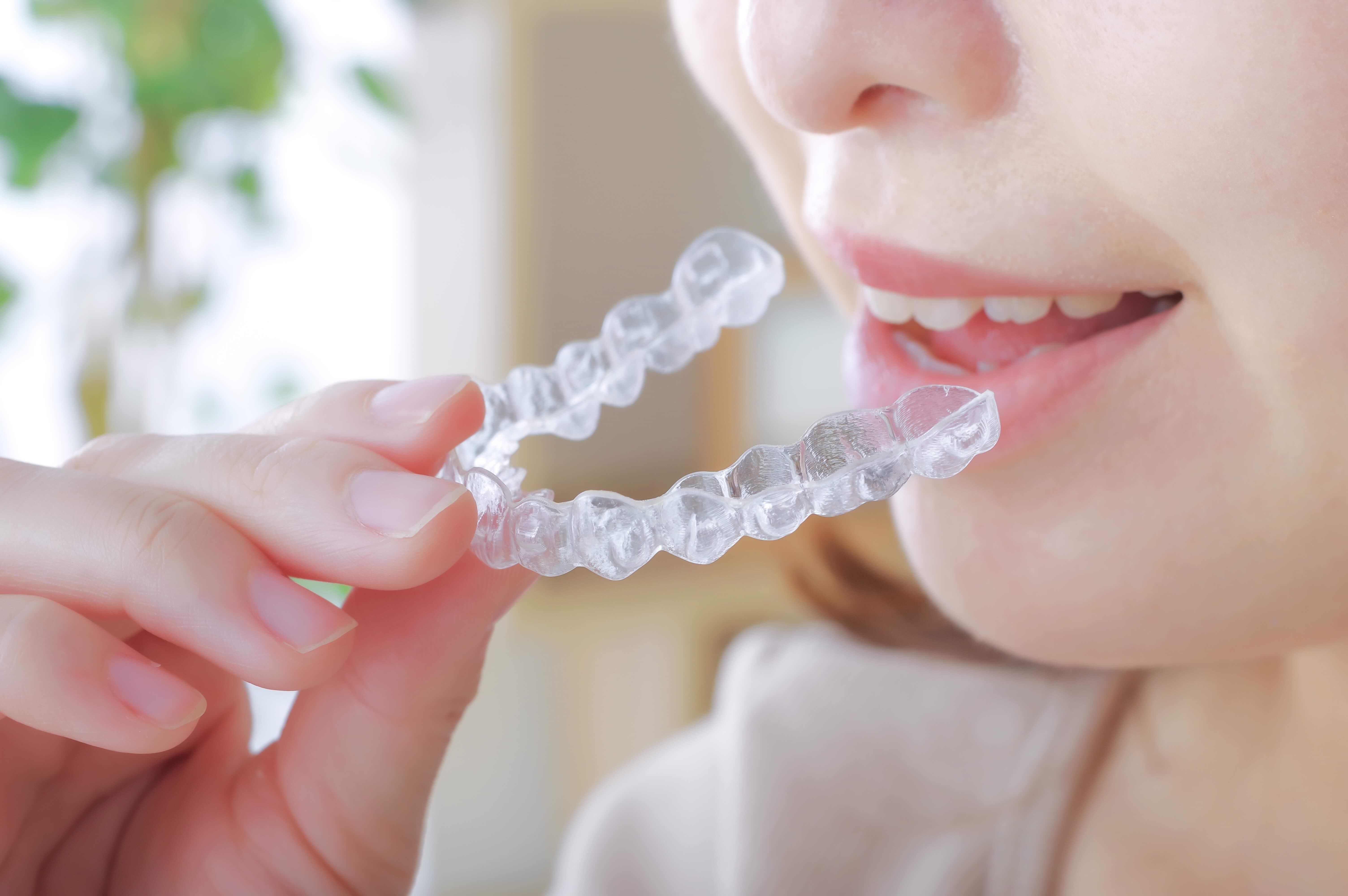 Custom dental night guard