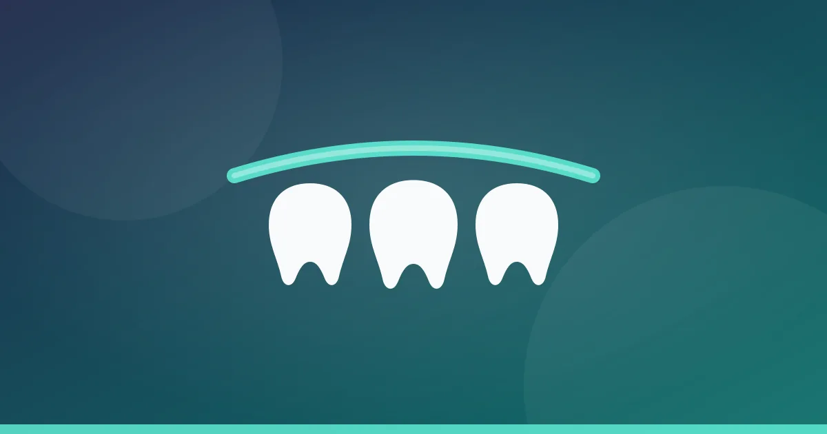 Custom vs over-the-counter night guards comparison at Serenity Dental of Bloomingdale -- custom dental office guards costing $300 to $800 with 5-10 year lifespan and precise fit versus boil-and-bite OTC guards at $20 to $50 with 3-12 month lifespan and approximate fit, plus mail-order custom guards at $100 to $200 as middle option, with detailed analysis of fit precision, pressure distribution, durability, protection quality, and long-term cost-effectiveness across all three categories