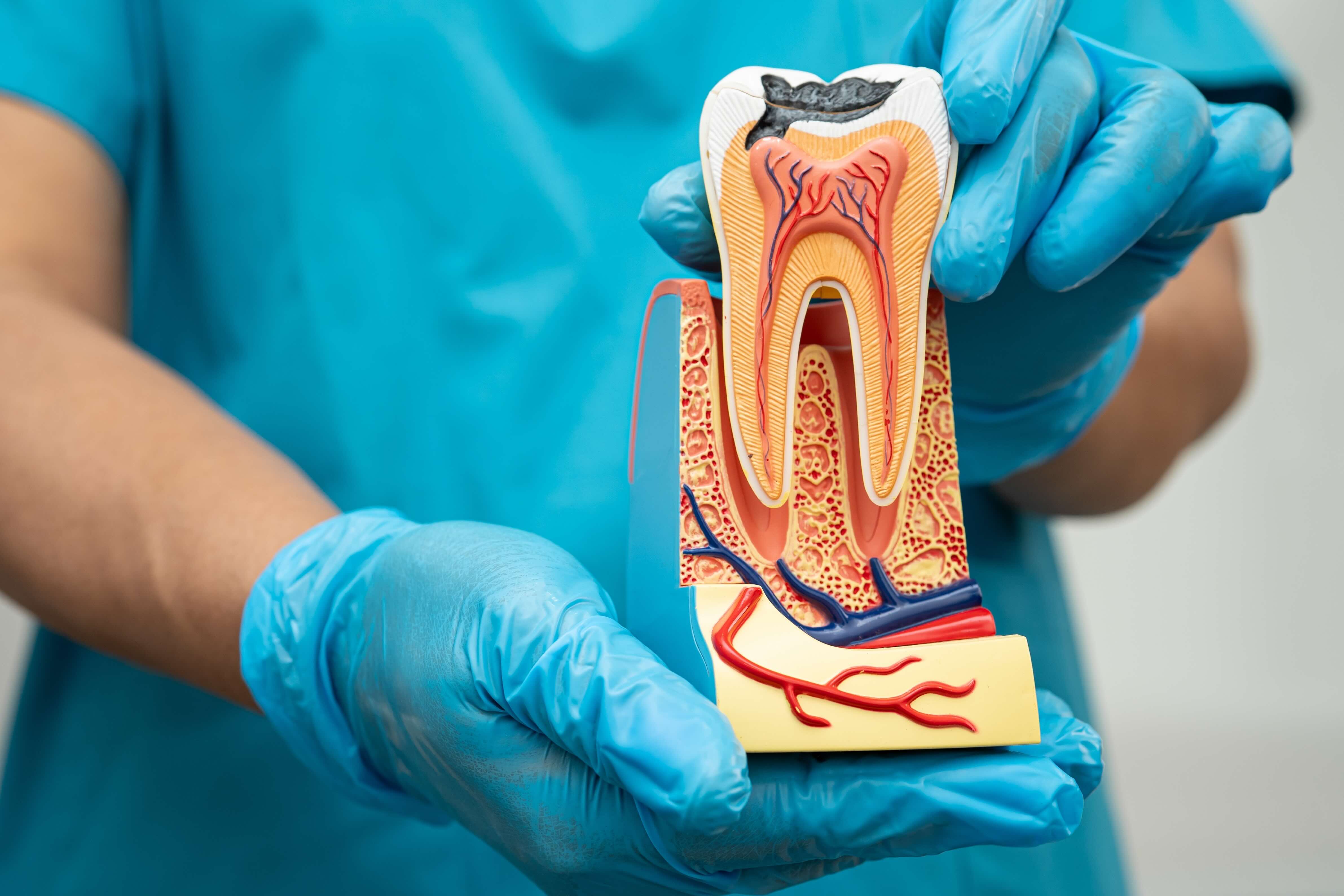 Root canal treatment and tooth pain relief