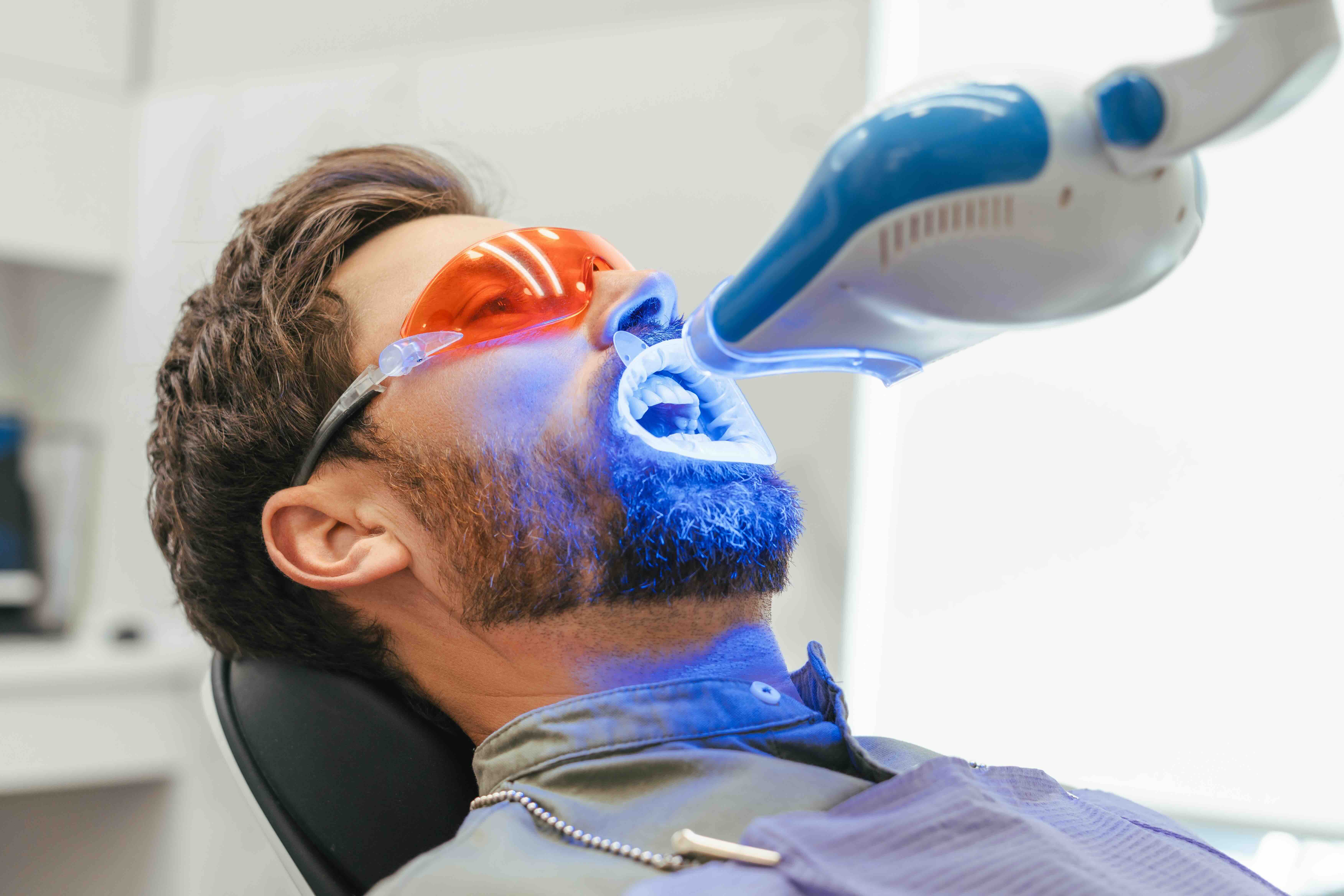 How to remove teeth stains at Serenity Dental of Bloomingdale -- surface stains from coffee tea and tobacco respond to professional cleaning and whitening toothpaste while internal yellow and gray stains in the dentin require peroxide whitening with custom take-home trays or in-office Zoom